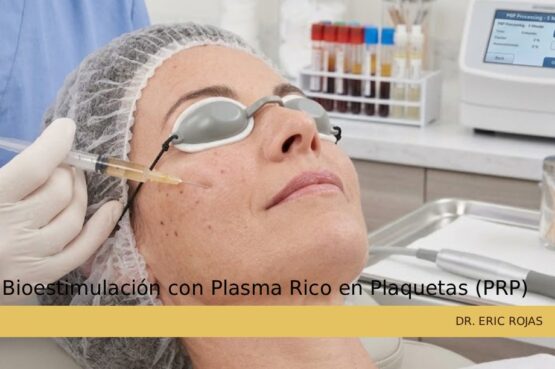 Terapia de bioestimulación celular con plasma rico en plaquetas
